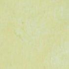 Arianna fue intervenida quirúrgicamente para remover su prótesis mamaria.