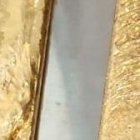 Cuatro barras de oro fueron extraídas del cuerpo del ciudadano.