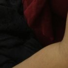 Por los latigazos, estas marcas quedaron en el cuerpo de la mujer.