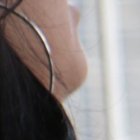 En los brazos de la mujer atacada por dos delincuentes aún se observan las huellas de la agresión. Teme salir de casa.