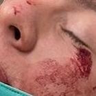 El cantante se encuentra estable luego del siniestro provocado por otro conductor.