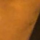 En medio de la desesperación, unos moradores buscaban atención para Ronald Alarcón.