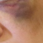 Cinco delitos habría cometido el agresor. La pena sería de más de 10 años de prisión.