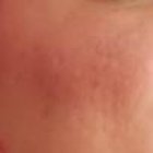 Continúa con 

reposo médico, aunque ya se ha pegado sus escapadas.