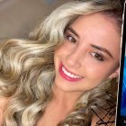 Génesis Jaramillo se operó el rostro este miércoles 26 de abril.