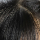 Niños han presentado algunos síntomas de este síndrome.