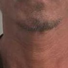 El detenido registra antecedentes penales por tráfico de estupefacientes.