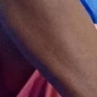 Las personas heridas fueron llevadas hasta diferentes casas de salud luego de lo sucedido.