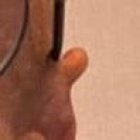 Dedicó su vida al estudio y reconocimiento de su enfermedad.