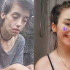 La joven se ha convertido en un ejemplo de vida.