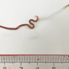 El gusano 'Pseudoterranova azarasi' mudando la cutícula externa.