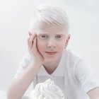  El albinismo no es una enfermedad, sino una condición genética que los hace diferentes en su piel. 