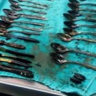  Dentro del estómago del chico encontraron 20 cucharas, 4 tenedores. 7 cepillos de dientes, un anillo y una cadena. 