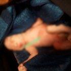  La pequeña de 36 semanas de gestación fue abandonada totalmente desnuda. 