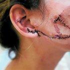  Cerca de 50 puntos de sutura le tuvieron que coger a la agredida en su rostro. 