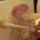  Cada vez son más los chinos, de toda edad y condición, que optan por la cirugía como una forma de dejar atrás sus complejos. 