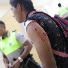  Así quedó el brazo del hombre. 