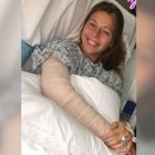  La joven fue enviada al hospital por rompimiento del codo. 