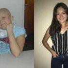  Imágenes de la argentina, de 18 años, con su antes y después de que venciera la enfermedad. 