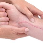  Ambos frutos tienen una dosis alta en vitamina C, la cual ayuda con la cicatrización. Tome en cuenta también a los antioxidantes. 