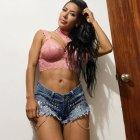  El diagnóstico médico dio como resultado una infección causada en las prótesis mamarias por la presencia de biopolímeros. 