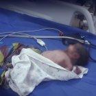  El bebé de sexo masculino fue abandonado en un terreno baldío cerca de la basura.  