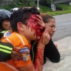 Rufo Chacón intentó quitarse la vida luego de quedar ciego por los perdigones que un policía venezolano le disparó. 