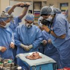  Médicos preparan el trasplante completo de rostro  