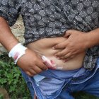  El morador recibió un disparo en la mano derecha. El tiro salió y se alojó en su abdomen. El hombre está estable. 