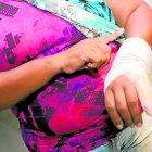  La señora contó que aún se recupera del golpe sufrido en su mano izquierda.  