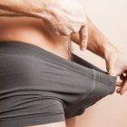  Referencial. El hombre estuvo un mes con su miembro erecto. 