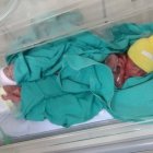 El nacimiento de Victoria, Julieta y Delfina Chainski es algo insólito y varios medios argentinos han cubierto la noticia.