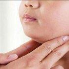  Si la persona presenta problemas debe ser llevada al médico de inmediato. 