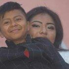  Johna, un joven de 19 años, sufre una extraña condición que le impide el normal crecimiento.  