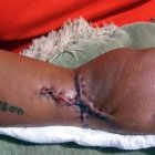  La agredida dijo que los tendones no le valen y no puede mover la mano, debido al corte que sufrió. 