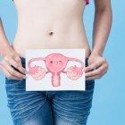  Los tumores de ovarios más frecuentes son el cistoadenoma, que es tumor benigno y el cistoadenoma carcinoma, que es el tumor maligno. 