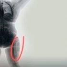  Mujer es arrestada por traficar droga en sus muslos. 