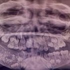  Los tamaños de los dientes variaban de 1 a 15 milímetros. 