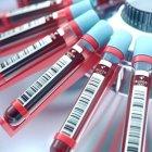  Científicos alemanes llevaron adelante un experimento con el que, a través de análisis de sangre, pudieron predecir el deceso de más de 5 mil personas.  