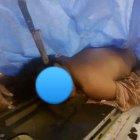  El hombre quedó con un cuchillo de 25 centímetros clavado en su cabeza 