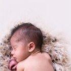  La espina bífida es una condición de nacimiento.  