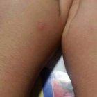  La página de Asociación contra el Acoso Escolar compartió imágenes de las heridas de uno de los estudiantes. 