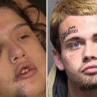  El agresor durante una hora golpeó a la joven, cuando se cansó decidió escribir con un cuchillo en su frente. 