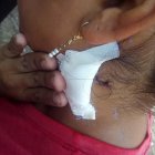  La mujer presenta una cuchillada a la altura del cuello. La intención de su expareja, al parecer, era asesinarla. 