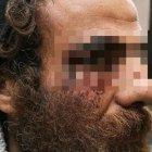  El supuesto atacante fue detenido. Lo identificaron porque le faltaba un botón en su chaqueta, que se habría arrancado en el forcejeo con la víctima. 