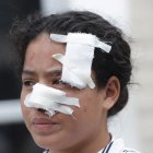  Las heridas de la muchacha están cubiertas con esparadrapo. 