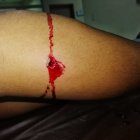  El herido fue llevado a una casa asistencial donde se recupera. 