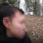  Una niña de nacionalidad china sufre progeria. 