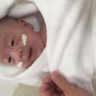  El bebé nació con 268 gramos a través de una cesárea de emergencia.  