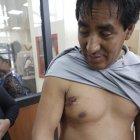  La víctima recibió un tiro en el brazo derecho y en la parte superior del tórax. 